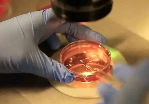4类群体的不同美国试管方案与费用解析